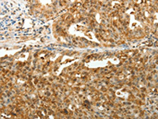 TENM3 Antibody (PACO18963)