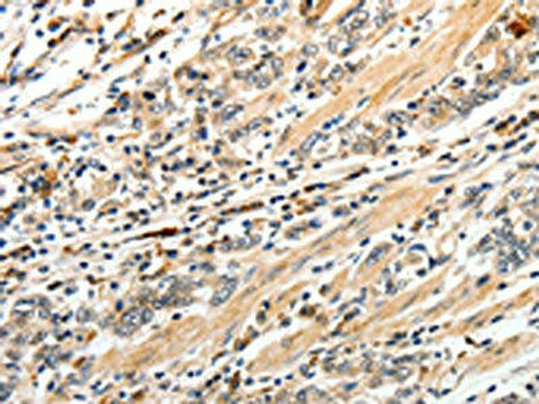 CD93 Antibody (PACO18980)