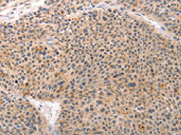 ACIN1 Antibody (PACO19043)
