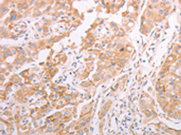 ADAMTS10 Antibody (PACO19055)