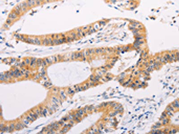 ADAMTS17 Antibody (PACO19063)