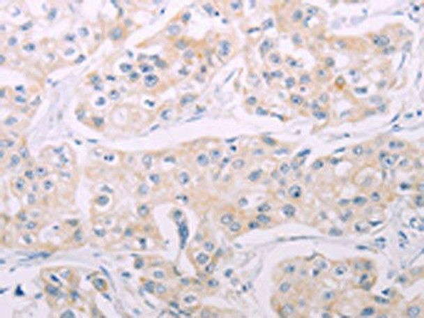 ADCY7 Antibody (PACO19066)