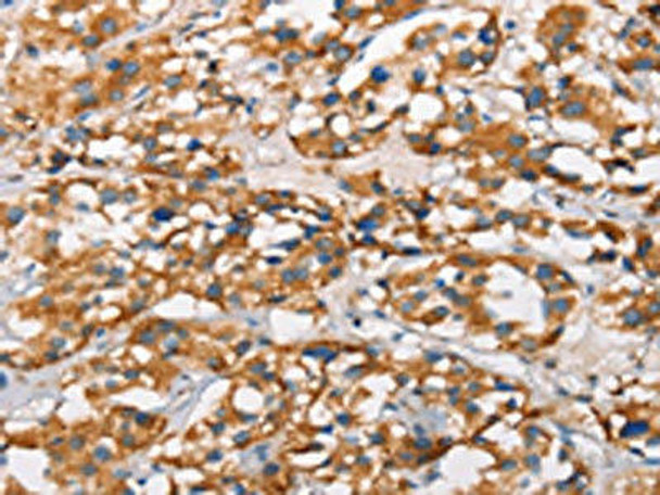 MARC1 Antibody (PACO19229)