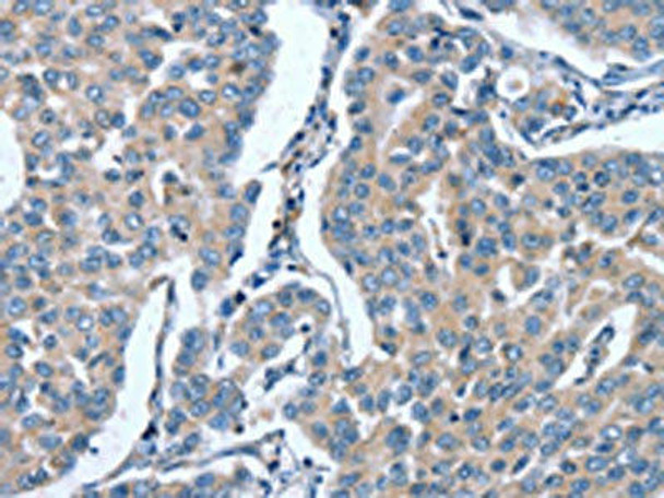 GINS1 Antibody (PACO19240)