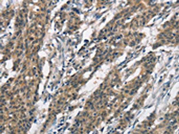 SH2B2 Antibody (PACO19321)