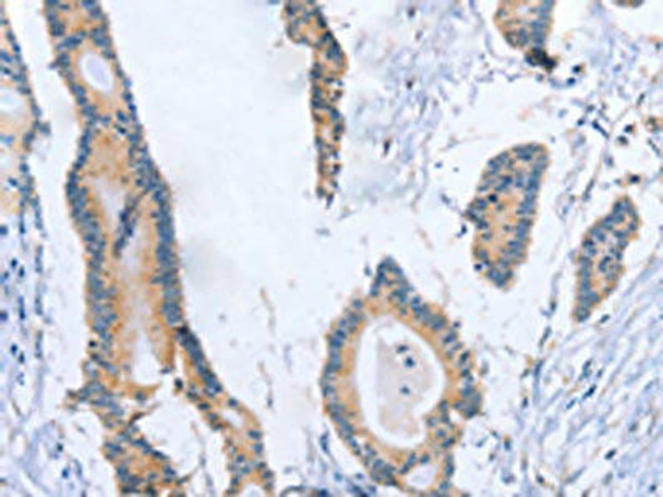 BOD1 Antibody (PACO19358)