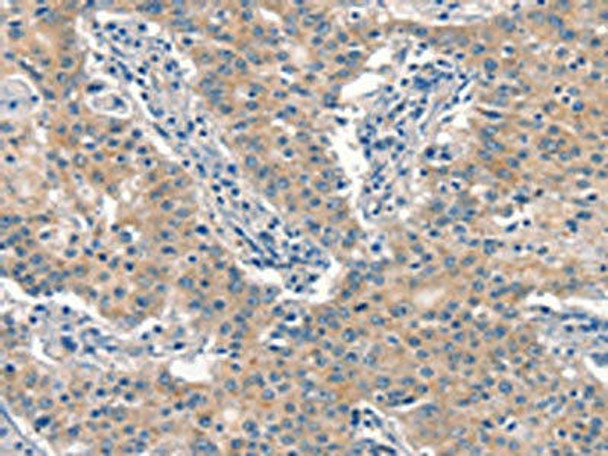 EID3 Antibody (PACO19588)