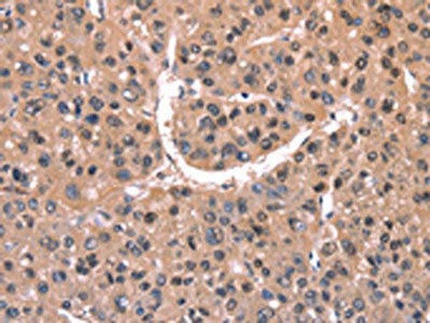 EXTL1 Antibody (PACO19638)
