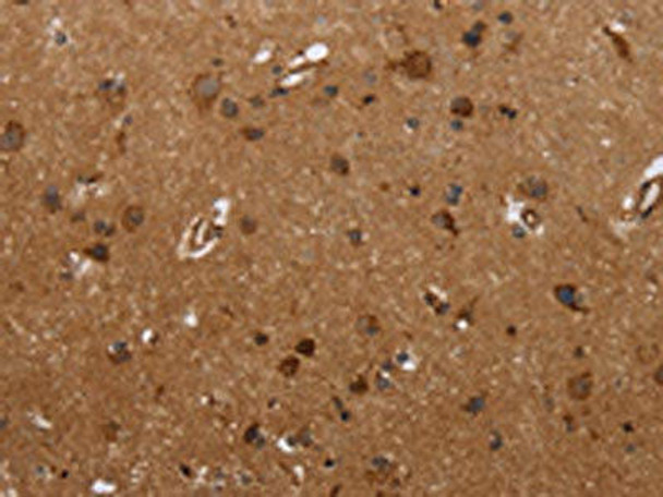 FMN2 Antibody (PACO19671)