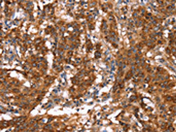 GAGE12I Antibody (PACO19690)