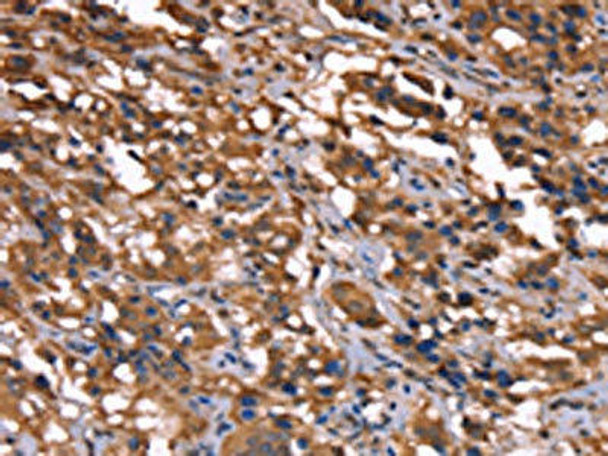 GREB1 Antibody (PACO19742)
