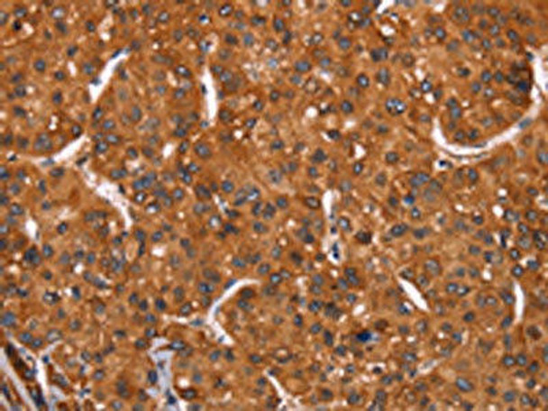 HRK Antibody (PACO19793)