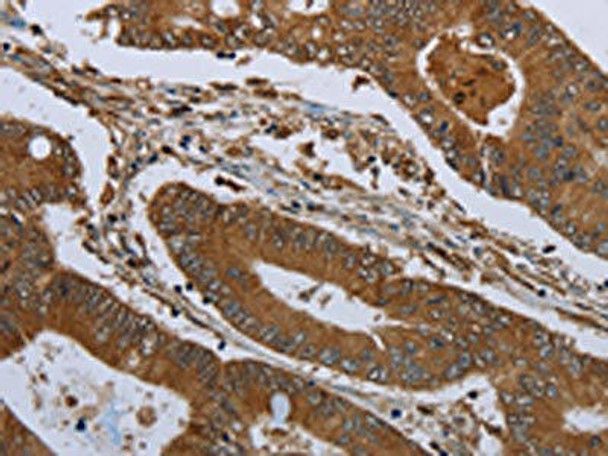 KLRF1 Antibody (PACO19914)