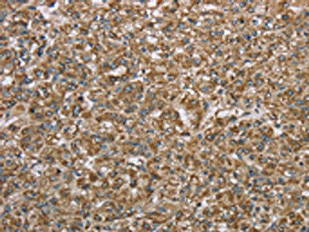 CERS4 Antibody (PACO19926)