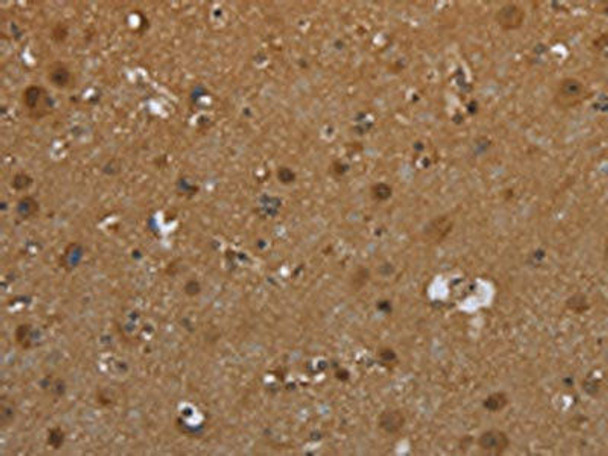 SCGB1D2 Antibody (PACO19941)