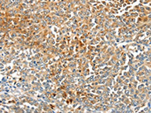 MAGEB2 Antibody (PACO19969)