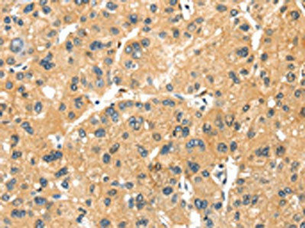 MAGEB2 Antibody (PACO19970)