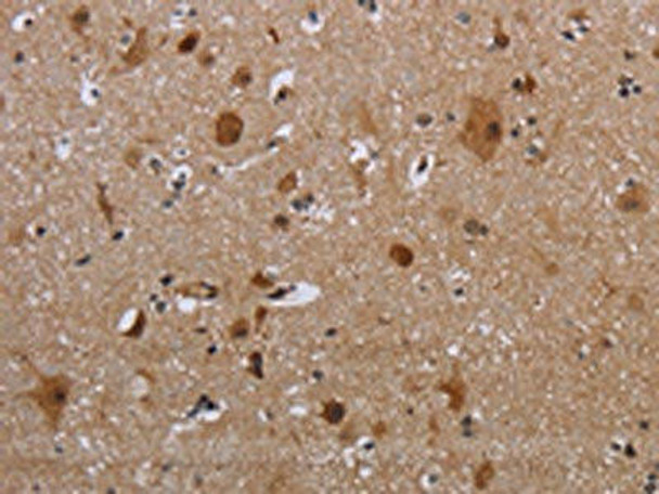 MAGEB18 Antibody (PACO19973)