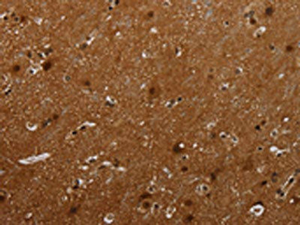 MAGEB18 Antibody (PACO19974)