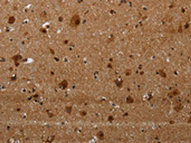 MAGEE1 Antibody (PACO19976)