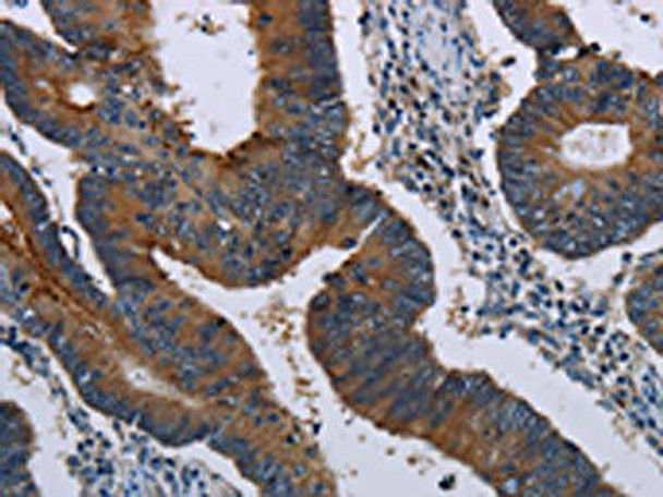 MAGEE1 Antibody (PACO19977)