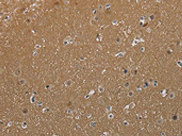 MAGEL2 Antibody (PACO19981)