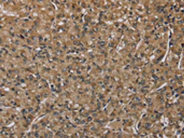 NLRP4 Antibody (PACO20062)