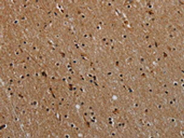 NLRP9 Antibody (PACO20105)