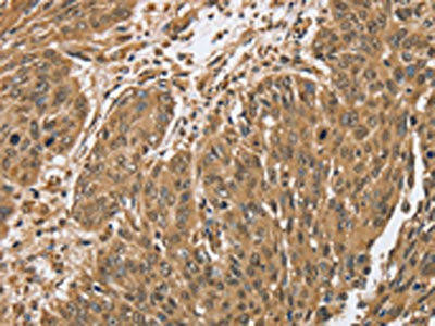 PTPN20A Antibody (PACO20292)