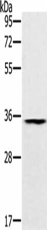 TRIM40 Antibody (PACO20360)