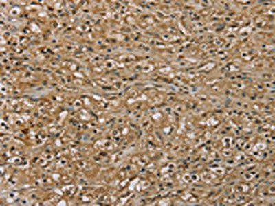 S100A13 Antibody (PACO20381)
