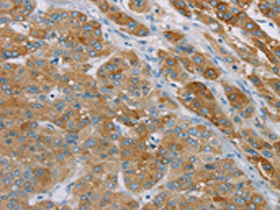 SAMD4A Antibody (PACO20384)