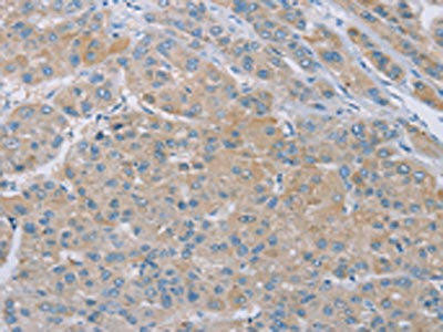 SAMD4B Antibody (PACO20386)