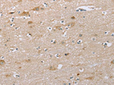 SAMD9L Antibody (PACO20390)