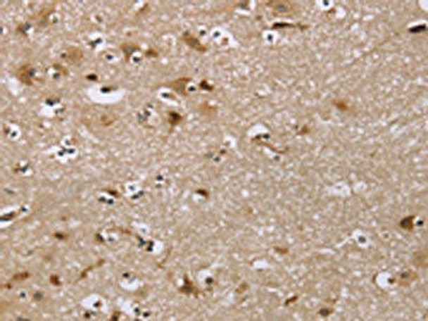 IQCJ Antibody (PACO20403)