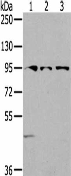 SEMA6A Antibody (PACO20422)