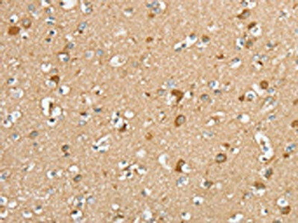 SERINC2 Antibody (PACO20438)
