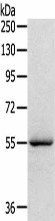 SERINC4 Antibody (PACO20442)