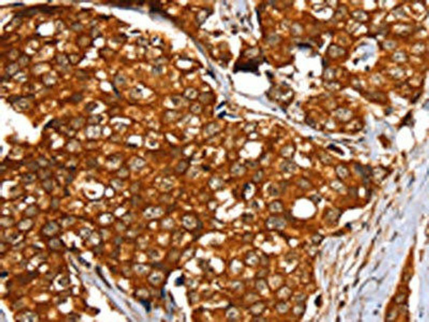 SLC24A3 Antibody (PACO20484)