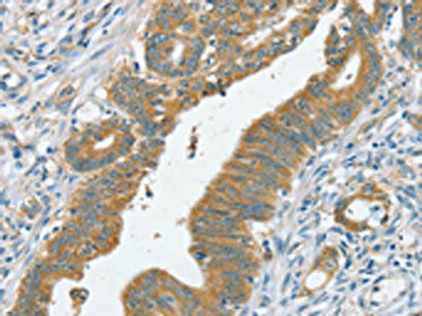 SLC39A3 Antibody (PACO20504)