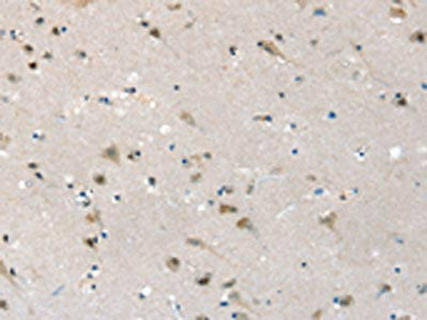 SLC6A7 Antibody (PACO20526)