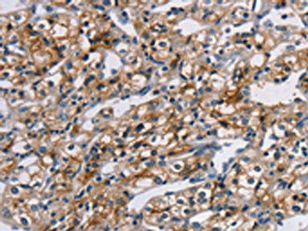 TM4SF1 Antibody (PACO20647)