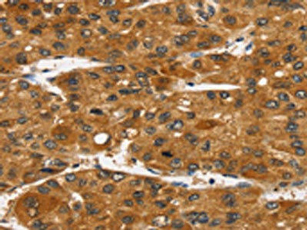 TACC2 Antibody (PACO20649)