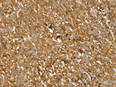 TMPRSS11F Antibody (PACO20716)