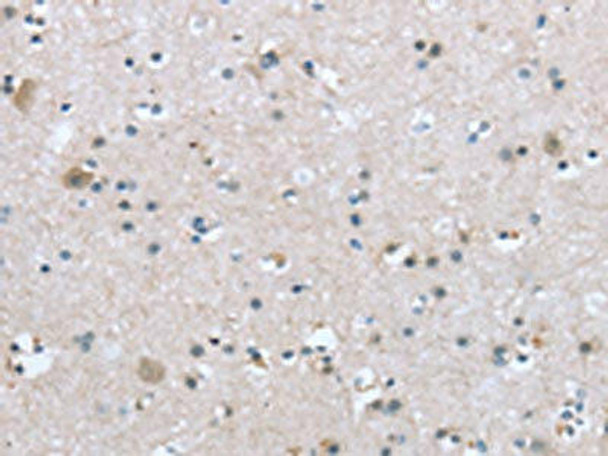 TRPM3 Antibody (PACO20765)