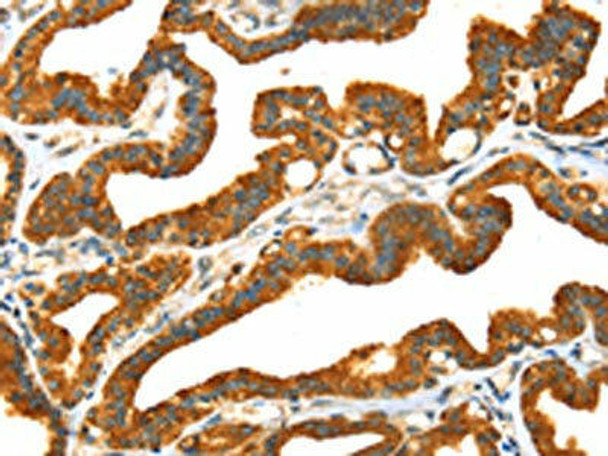 PRSS50 Antibody (PACO20775)