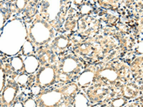 TSPYL6 Antibody (PACO20779)