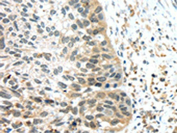 TSPY1/TSPY3 Antibody (PACO20781)