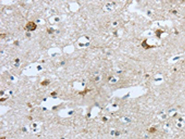TTBK1 Antibody (PACO20783)