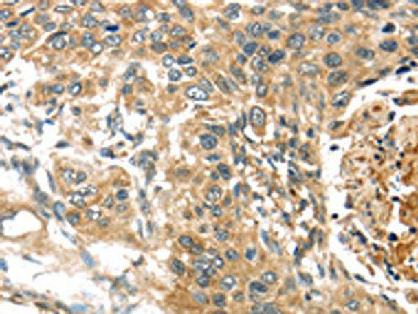 TTI1 Antibody (PACO20787)